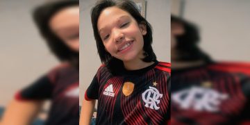 Saiba como está criança que perdeu couro cabeludo em parquinho no DF