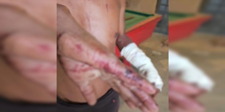 Facadas e sangue no chão: filho agride pai no DF e é preso pela PM