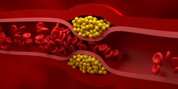 Especialistas indicam 7 melhores alimentos para reduzir o colesterol