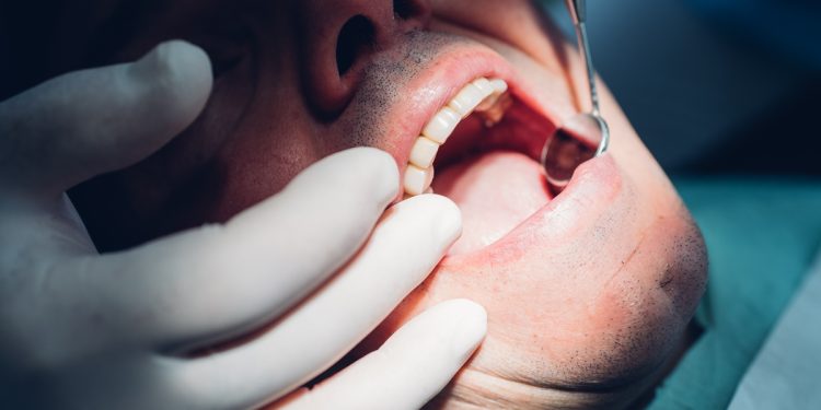 Paciente perde dente após erro em canal e clínica é condenada no DF