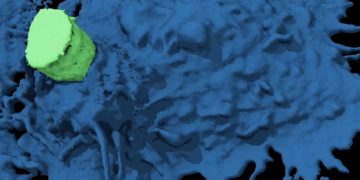 Estudo registra célula de câncer fugindo das defesas do organismo. Veja vídeo