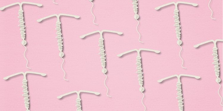 O DIU pode falhar? Veja as chances e o que diz a obstetra