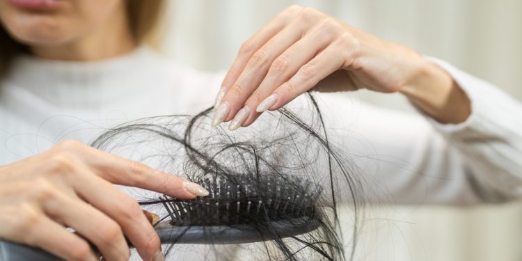 Dermatologista conta 5 sinais de alerta de que a queda de cabelo é séria