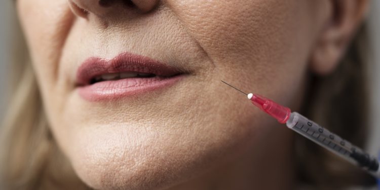 Anvisa proíbe venda de bioestimulador de colágeno Sculptra falsificado