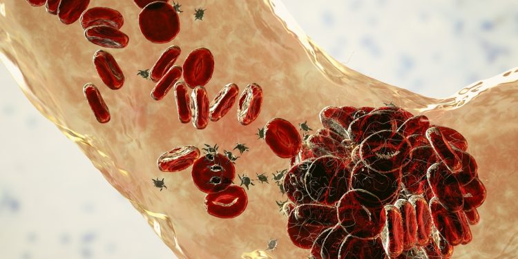 HPV: sangue menstrual pode ajudar a detectar câncer do colo do útero