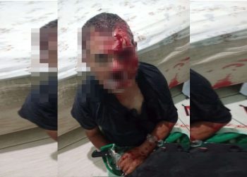 Torturadora mascarada desfigurou vítima com faca e isqueiro no DF. Veja vídeo