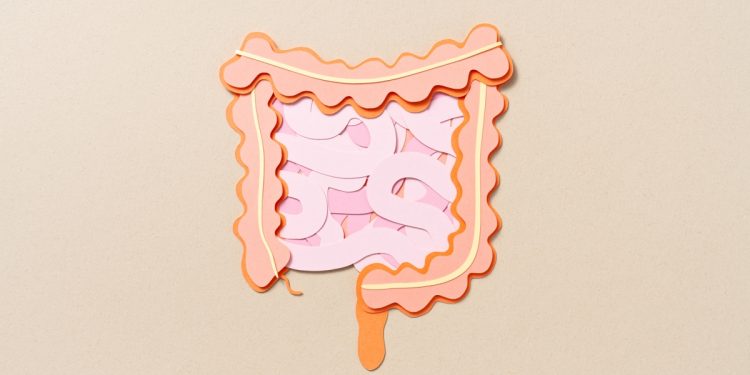 Coloproctologista conta os sintomas da síndrome do intestino irritável