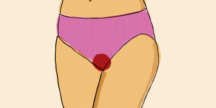 Ginecologistas listam as 6 principais razões de atraso na menstruação