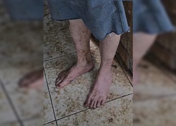 Idoso é resgatado pela polícia após ser abandonado com 15 cães no DF