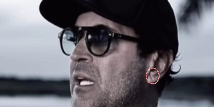 Sinal de Frank: cardiologista explica quadro que pode anteceder infarto