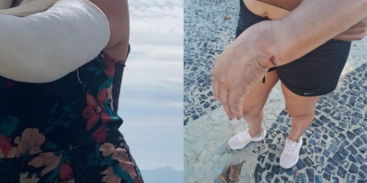 “Me custou duas cirurgias”, diz turista indenizada após seguro negado