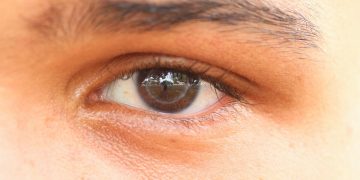 Recusa familiar na hora da doação de órgãos varia em função do governo?