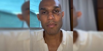 Advogado é agredido em bar no DF por militares do Exército após racismo. Veja vídeo