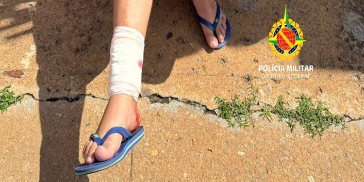 Pit bull é morto pela PM após atacar pessoas e matar cadela no DF