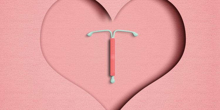 DIU hormonal e risco de câncer de mama: o que se sabe sobre esse elo