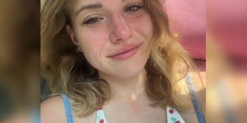 Infecção grave após roer unhas quase faz jovem perder o dedo. Entenda