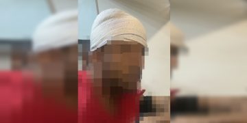 Homem é agredido ao ser confundido com gêmeo que marcou date com ex. Veja vídeo