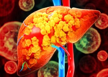 Hepatologistas explicam o que causa gordura no fígado