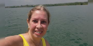 Com câncer colorretal, mulher alcança remissão com apenas uma cirurgia