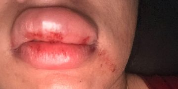 Tapas, socos e enforcamento: vereador é denunciado por agredir mulher