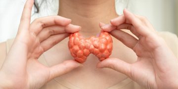 Endocrinologistas listam os principais sintomas do hipotireoidismo