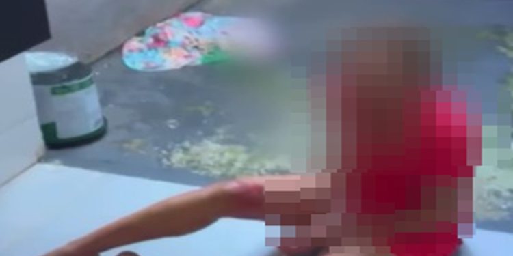 Queda do 3º andar: marido torturou mulher em apartamento durante dias