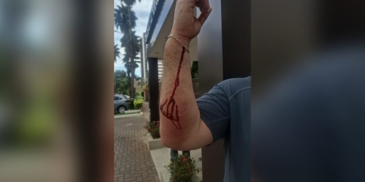 Morador de rua morto em Águas Claras tinha histórico de agressões