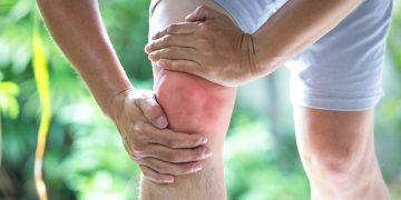 Uso de joelheira pode ajudar a aliviar dor da artrose, aponta estudo