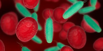 Anemia após os 60 anos pode elevar risco de demência, aponta estudo