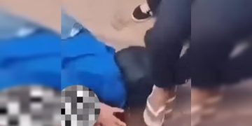 Mãe faz relato sobre estado de filho pisoteado na porta de escola