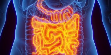 Confira os 5 principais sinais de que o intestino pode estar inflamado