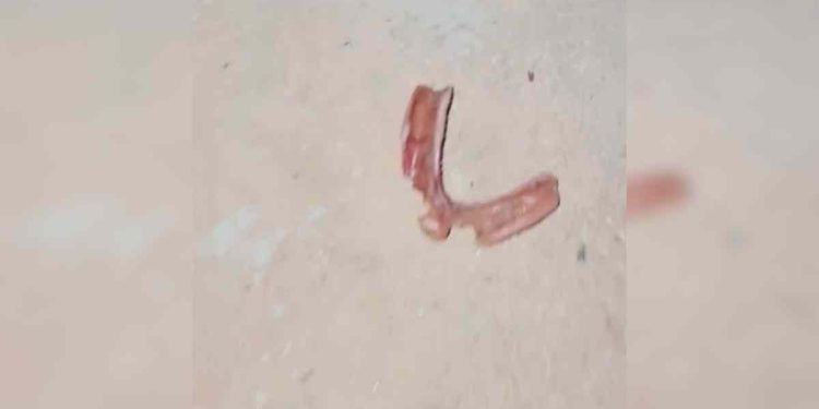 Sangue e dentadura no chão: cena brutal revela morte de italiano no DF. Veja vídeo