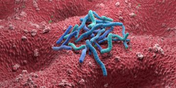 Gastroenterologista explica os sintomas da infecção por H. pylori