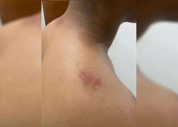 Família denuncia violência policial contra adolescente no DF; PM nega. Vídeo