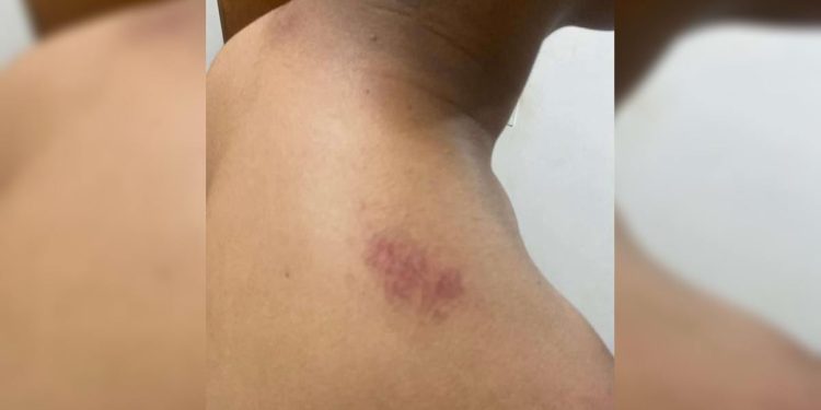 Família denuncia violência policial contra adolescente no DF; PM nega. Vídeo