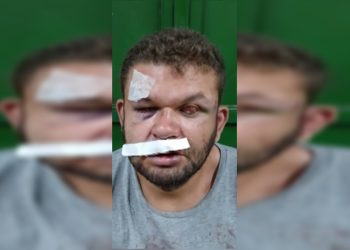 Homem cego e irmão são agredidos durante discussão por marmita extra
