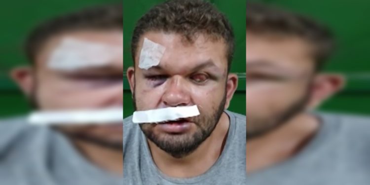 Homem cego e irmão são agredidos durante discussão por marmita extra