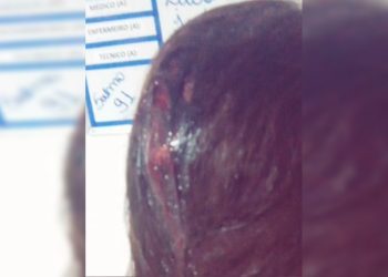 Mulher é apedrejada e foge de agressor no DF: “Vou te matar”