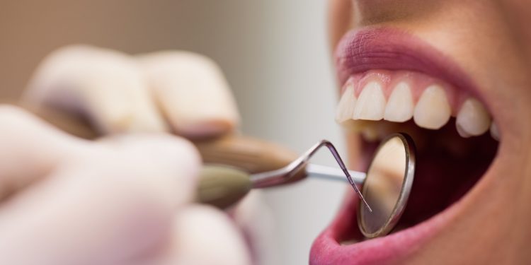 Tem medo de ir ao dentista? Saiba como superar esse trauma
