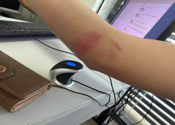 Após discussão, homem agride mulher com socos e chutes e é preso em GO