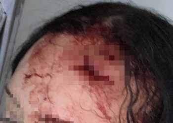 Após levar fora, homem rasga cabeça de mulher com garrafa no DF. Veja vídeo