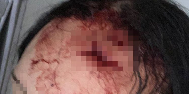 Após levar fora, homem rasga cabeça de mulher com garrafa no DF. Veja vídeo