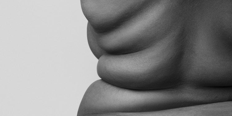 Médicos ensinam como tratar cada um dos 4 tipos de obesidade