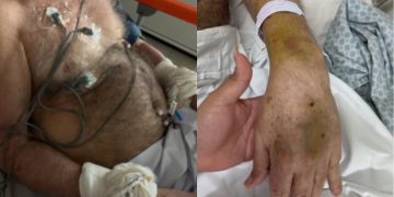 Paciente é amarrado em hospital do DF e família cobra respostas