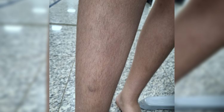 Aluno é agredido por 10 crianças dentro de colégio militar do DF