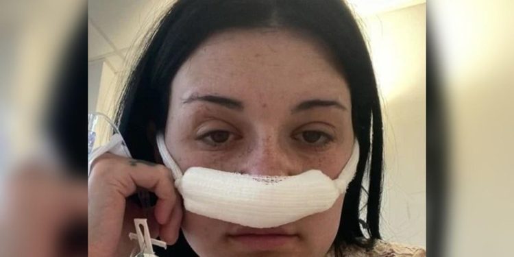 Mulher descobre tumor cerebral após sintomas tratados como estresse