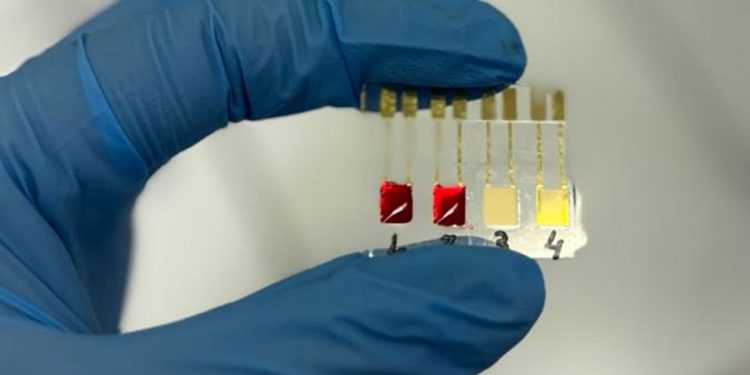 Biossensor brasileiro detecta câncer de pâncreas em fase inicial