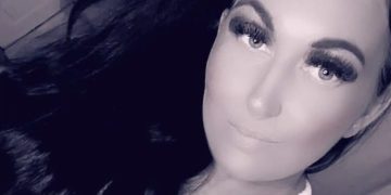 Cílios postiços esconderam sinal de tumor cerebral em mulher por meses