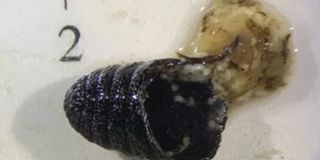 Com infecção rara, mulher espirra larvas e pupa de mosca