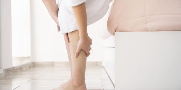 Varizes: saiba as principais causas e quando procurar um especialista